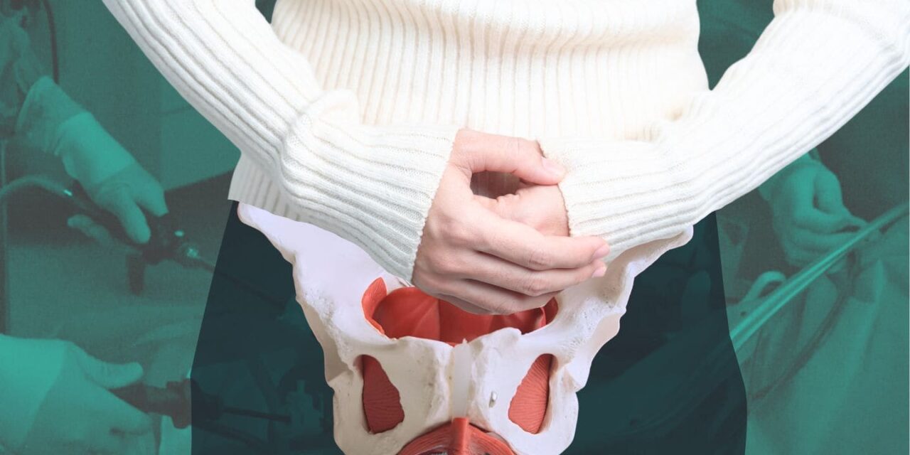 Prolapso vaginal: un problema común que afecta a casi la mitad de las mujeres