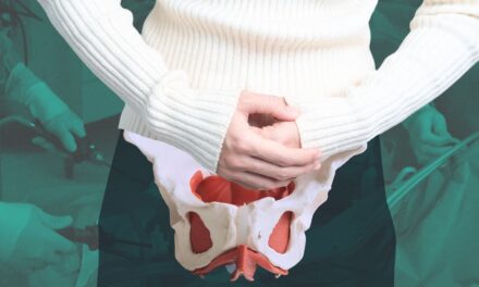 Prolapso vaginal: un problema común que afecta a casi la mitad de las mujeres