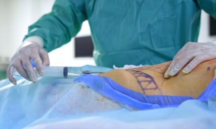 Ha efectuado Coespris 445 verificaciones sanitarias a establecimientos de cirugías estéticas durante 2025